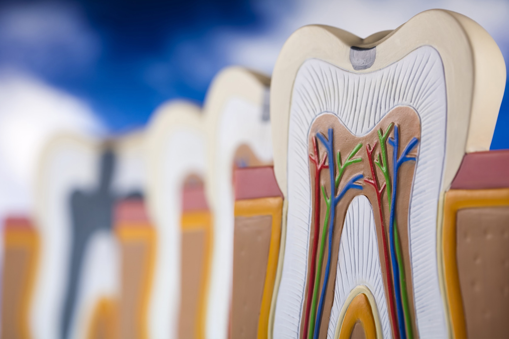 ROOT CANAL TREATMENT (ENDODONTIS)